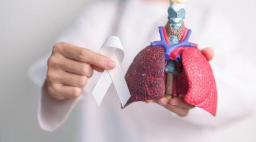 Cancerul pulmonar agresiv ar putea fi monitorizat printr un simplu test de sânge