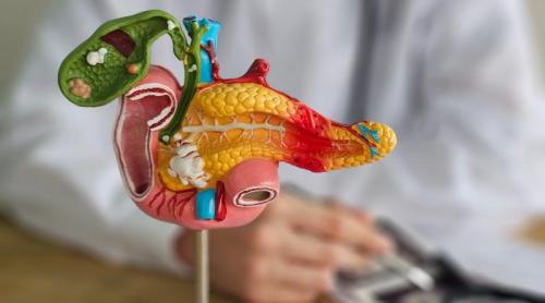 Cum păcălește cancerul pancreatic sistemul imunitar. Doar 5% dintre celule pot proteja tumora