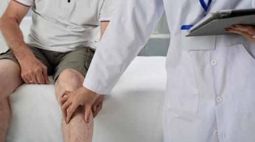 Hipertensiunea arterială poate accelera deteriorarea articulațiilor cauzată de osteoartrită printr o cale hormonală recent identificată