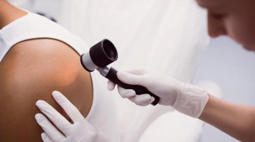 Pielea poate ascunde probleme pe care nici medicul nu le simte. Cum le detectează tehnologia