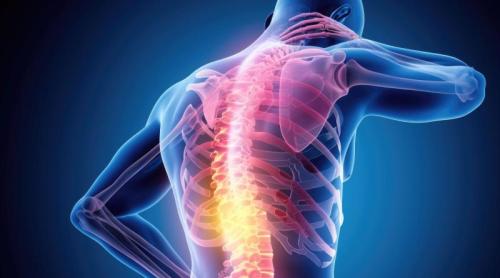 Spondiloartrita axială: diagnosticul pus la timp ar putea proteja coloana vertebrală pe termen lung