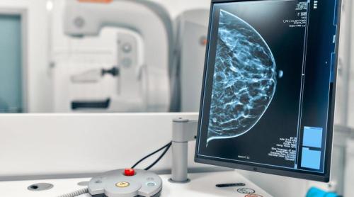 Testele de 2 minute care estimează riscul de cancer de sân. Dr. Ștefan Voiculescu (SANADOR): Boala poate apărea și fără antecedente familiale