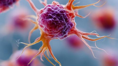 Un cancer tratat cu ani în urmă poate reveni în pancreas. Ce trebuie să știe pacienții