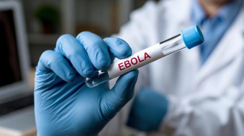 Virusul Ebola se extinde. Dr. Manuel Albela Miranda explică de ce este atât de greu de ținut sub control